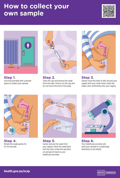 How to collect your own cervical screening sample — step by step guide